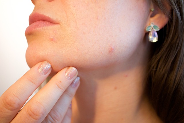 Acne Types and Causes: A Deep Dive
